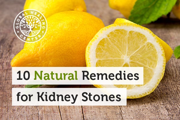 10-natural-remedies-for-kidney-stones