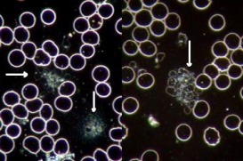 platelet-aggregation