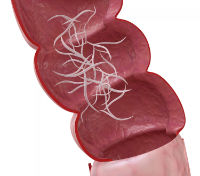 pinworm