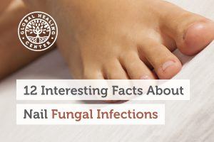 fungal-infection-blog-300x200