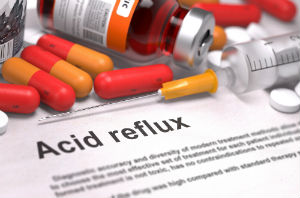 acid-reflux