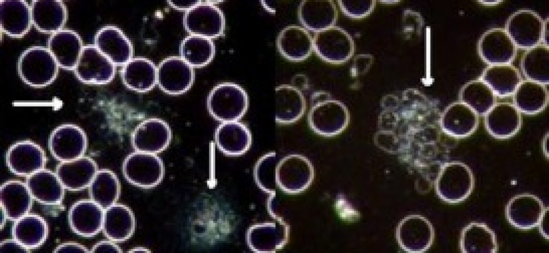 cropped-platelet-aggregation