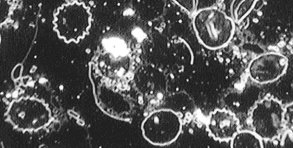 lba_high_developed_forms