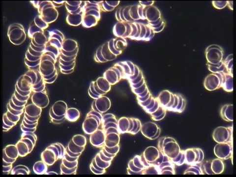 red_blood_cell_aggregation