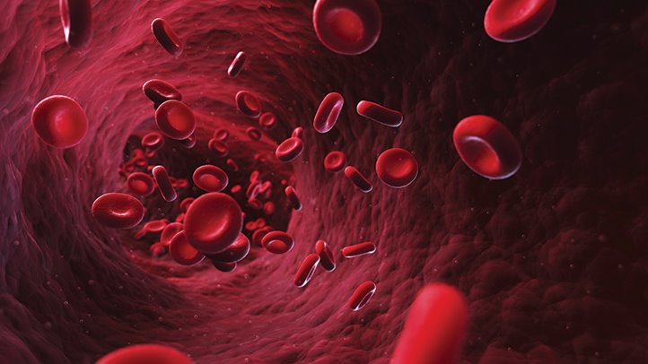 iron-def-anemia-722x406