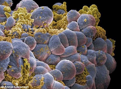 breast_cancer_cells