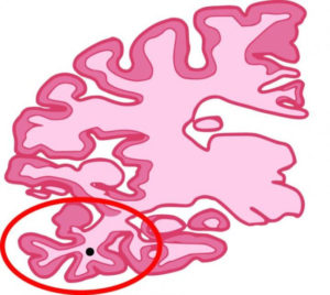 lateral-temporal-lobe-epigenetics-300x268
