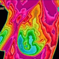 thermography