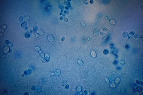 Is Cancer a Fungus? A New Theory