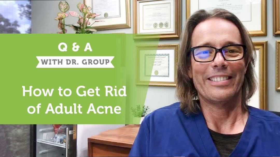 how-to-get-rid-of-adult-acne