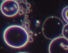 bacteria-and-symprotits-in-dark-field