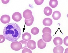 bacteria-in-stained-sample