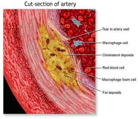 cut-section-of-artery