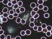 platelet-aggregation-in-darkfield-01