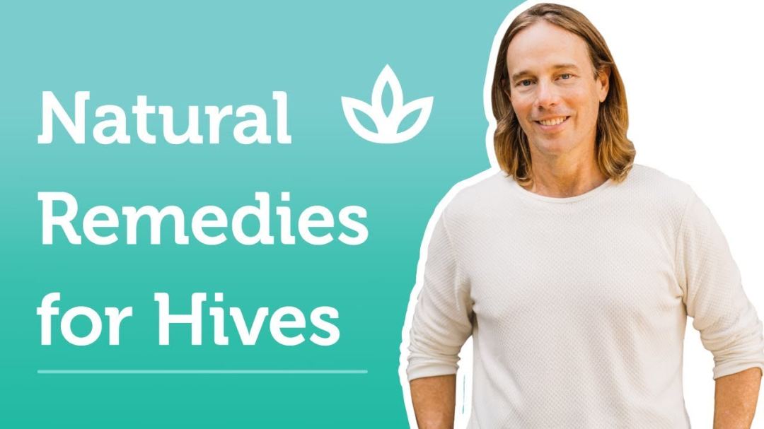 natural-remedies-for-hives