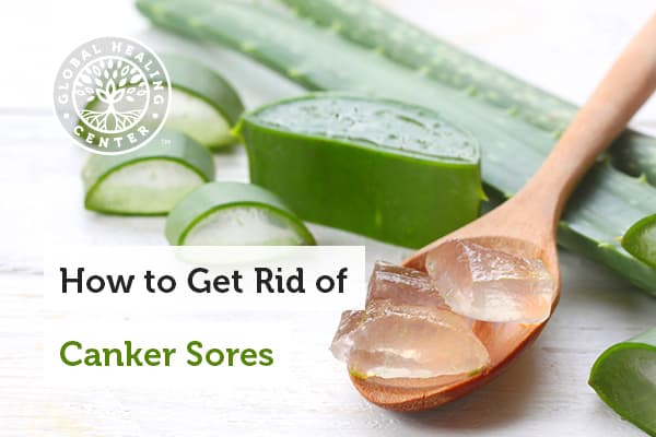 how-to-get-rid-of-canker-sores