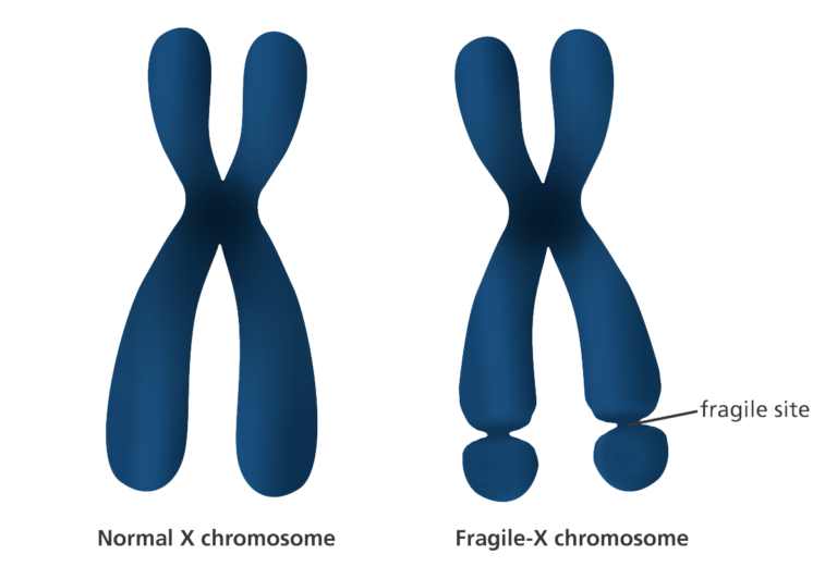 fragile-x-chromosome-768x532