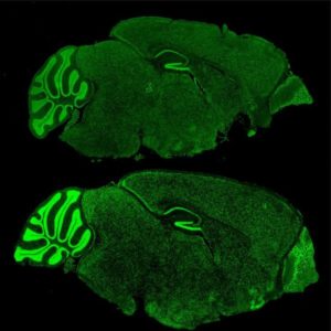 fragile-x-mouse-brain-300x300