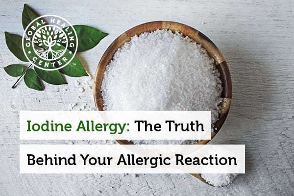 iodine-allergy
