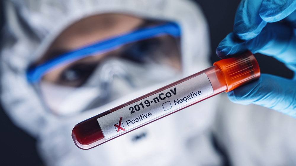 Coronavirus-Positive-Blood-Sample-Lab-Work