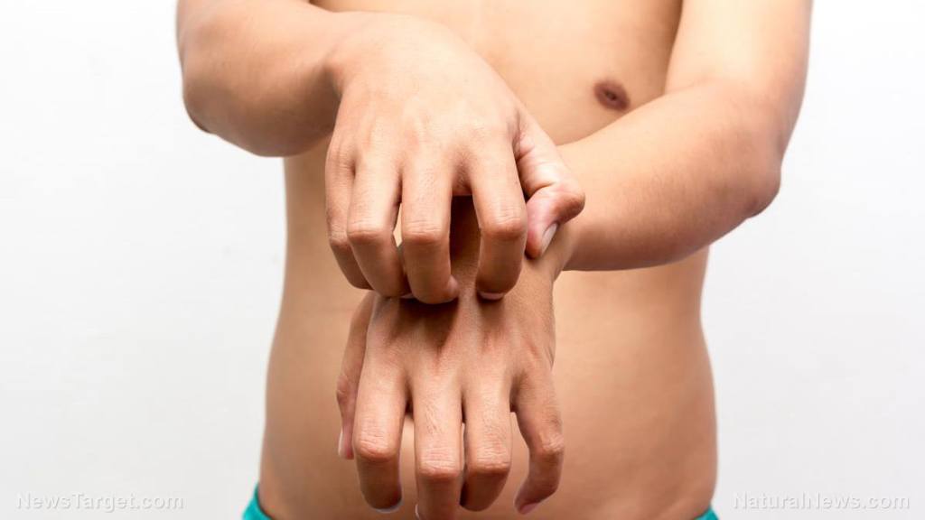 The survivalist’s simple guide to poison ivy: What it is and what to do if you’ve touched it