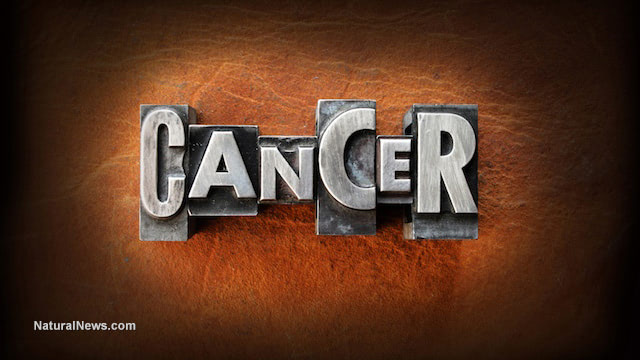 American Cancer Society admits conventional cancer treatment causes more cancer