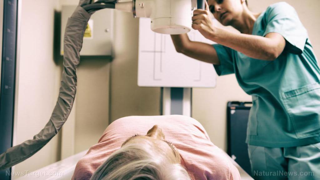 Some physicians refuse to promote healthy lifestyle changes in order to avoid stressing cancer survivors, reveals shocking study