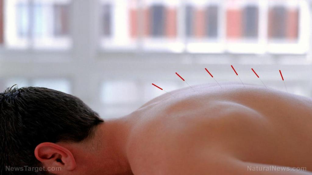 Acupuncture at these specific points alleviates pain in cancer patients