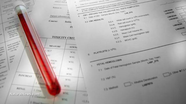 Severe childhood allergies to peanuts, eggs and dairy directly linked to 'trace' ingredients in common vaccines