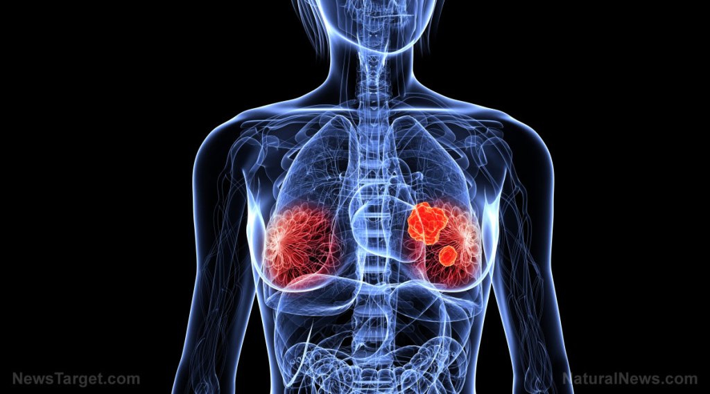 Reduce your risk of breast cancer by 21% by simply eating one more serving of veggies a day