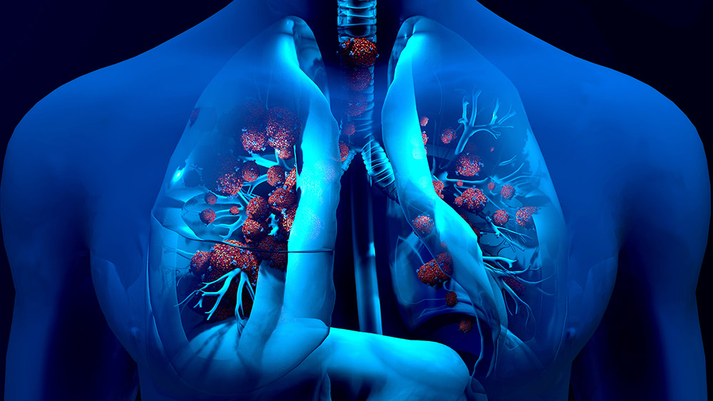 Coronavirus survivors face a long road ahead as they struggle with long-term damage