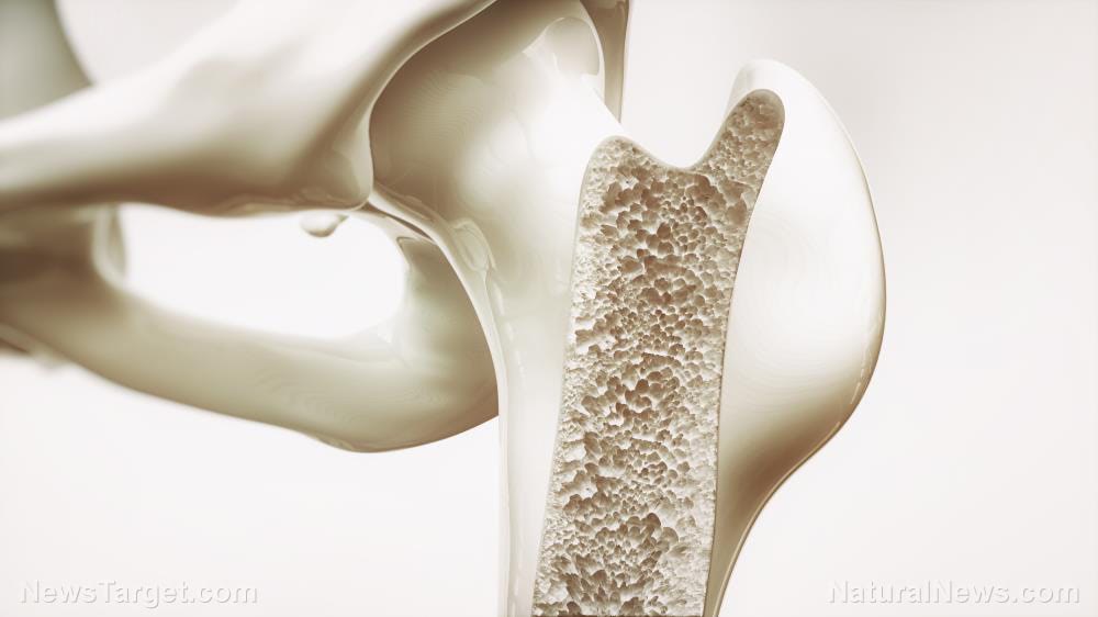Can intermittent fasting lower your risk of osteoporosis?