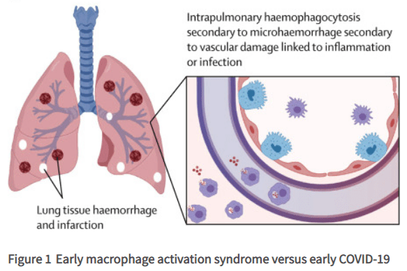 Cardiologist warns about covid vaccine fraud and hyper-inflammatory immune responses caused by the shots