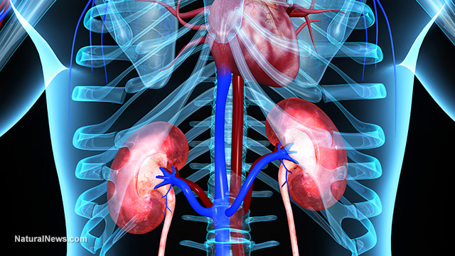 A powerful remedy to dissolve kidney stones