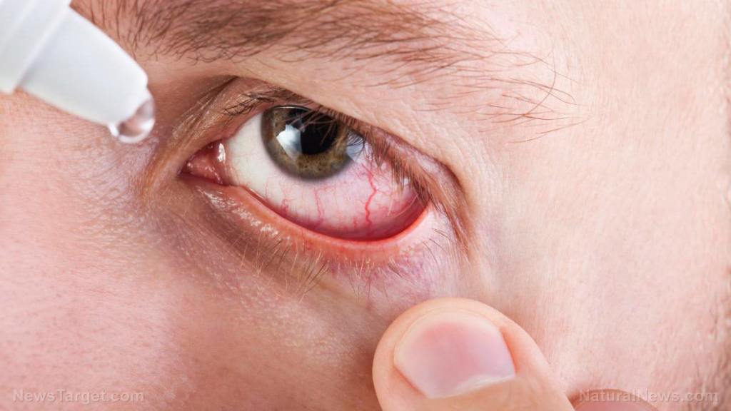 Study links Pfizer COVID-19 vaccine to eye inflammation