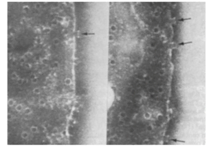 photograph of holes literally being drilled into healthy living cells by the antibodies now produced to counter the spike protein
