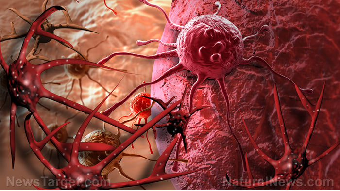 “World Without Cancer”: A deep dive into the world of alternative cancer treatments