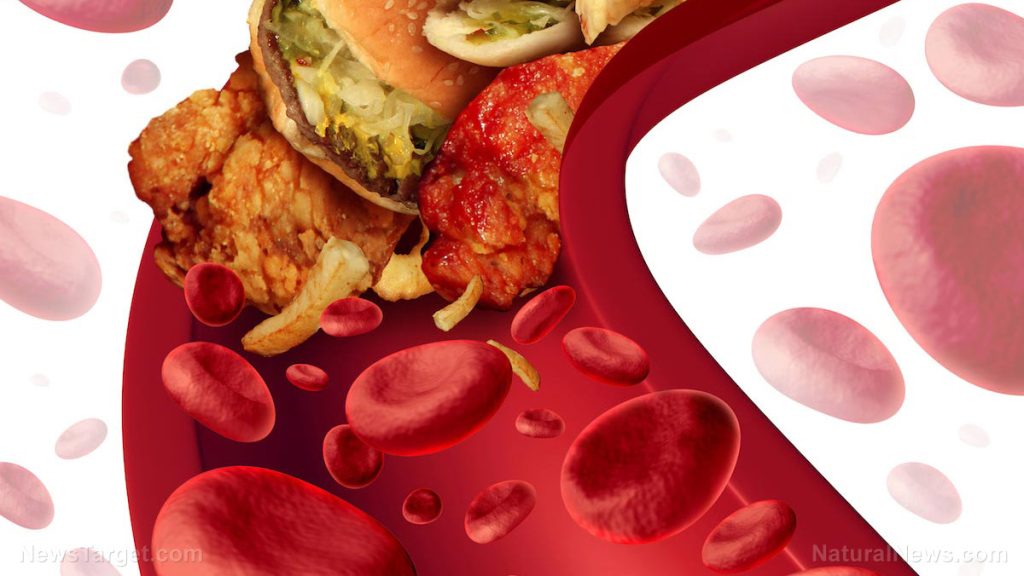 Top 6 ways humans clog their own blood, leading to early death by heart attacks, strokes, cancer and VACCINES