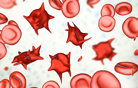 Dr. Richard Fleming discusses negative effects of Pfizer’s vaccine on red blood cells