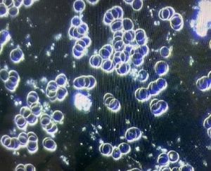 dark field blood examination