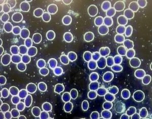 The dark field blood examinations 2