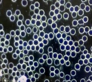 The dark field blood examinations 4