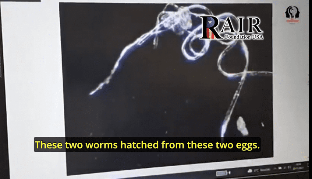 researchers found “worms” that appear to have been “hatched” within the vaccine serum