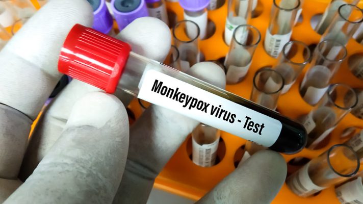 HHS claims BARDA’S monkeypox vaccine purchase NOT related to recent outbreak in the US