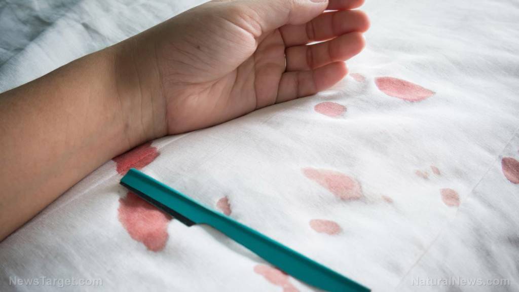 Depopulation twofer: Youth suicide rates are HIGHER now that children are being pushed to go “trans”