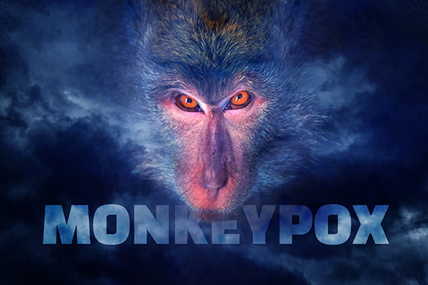 WHO declares monkeypox a “global health emergency” with just FIVE deaths in the world and 99% of cases afflicting homosexuals