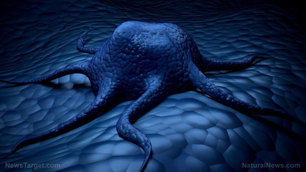 Top 8 causes of cancer you most likely DON’T KNOW about yet