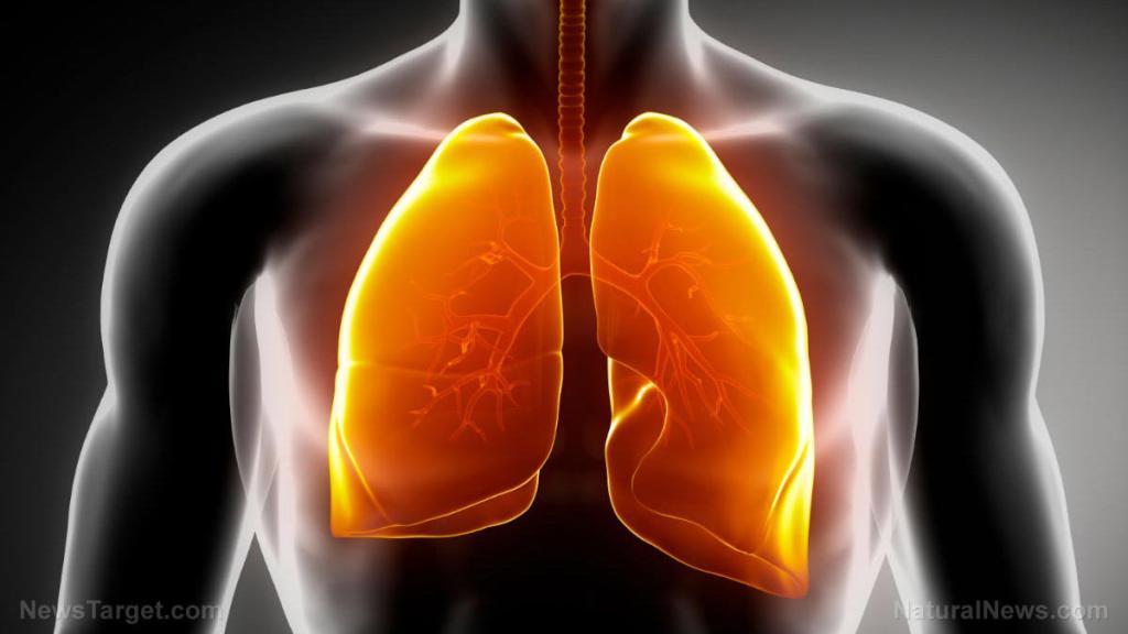 MEDICAL SCIENCE WARNING: Lung transplant recipients develop respiratory distress and organ rejection after second dose of covid-19 vaccine