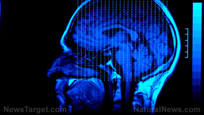 mRNA covid injections causing some recipients to experience drastic personality changes: WHY?