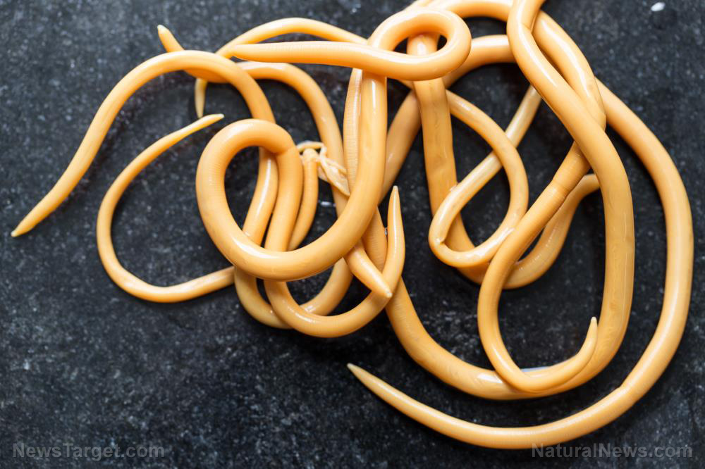 Parasites have killed more humans than all wars combined – is your body fighting a parasite war right now?